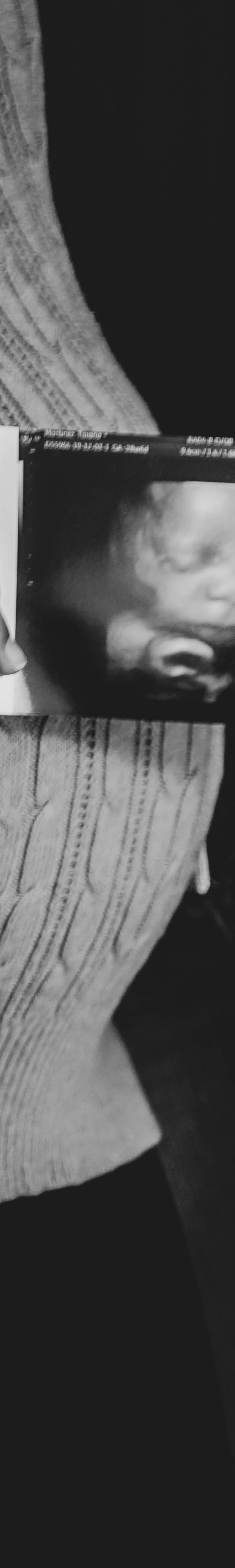 임산부 치아 건강 관리법 미리 알아두기 관련 이미지 24