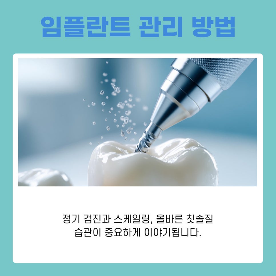 역삼동 임플란트 치아 상태와 생활 습관까지 함께 살펴야 하는 이유 관련 이미지 10