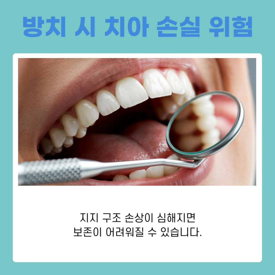 삼성동 치과 풍치 치료 방치하면 생길 수 있는 문제 관련 이미지 8