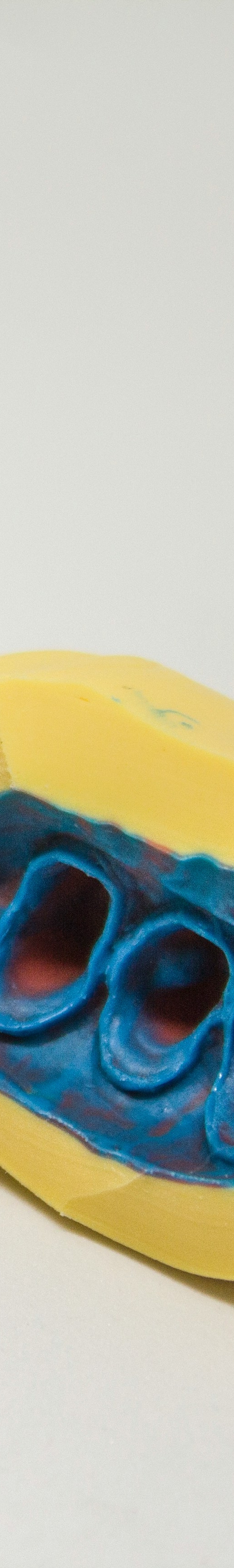 임플란트 후 관리의 중요성 관련 이미지 25