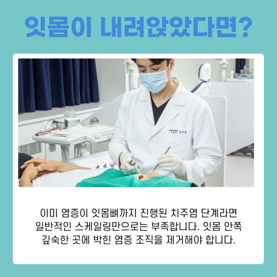 치아 건강의 핵심 서초역치과 연 1회 스케일링으로 치주염 예방 관련 이미지 6