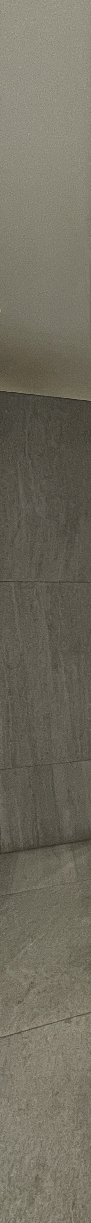 자연치아를 최대한 보호하는 최소삭제라미네이트 관련 이미지 19