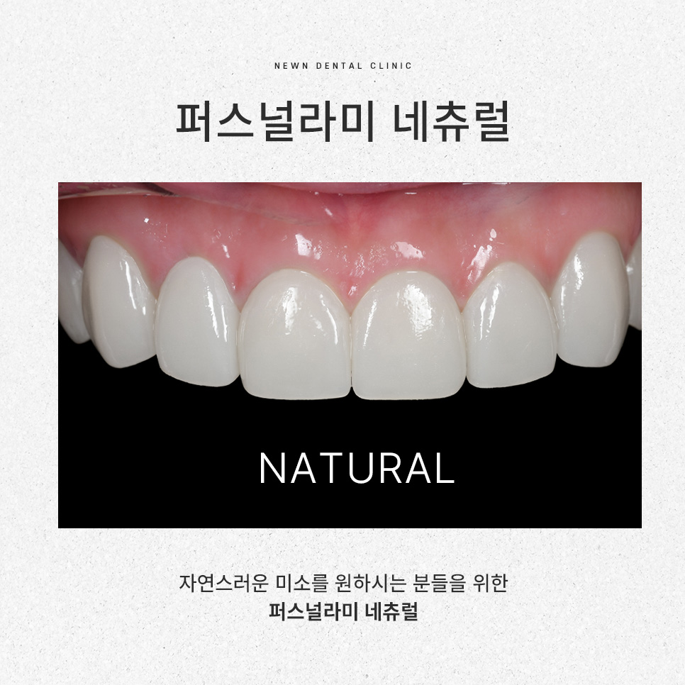 [뉴엔치과] 강남역 나에게 맞는 스마일 디자인,퍼스널라미 제로와 네츄럴 관련 이미지 5