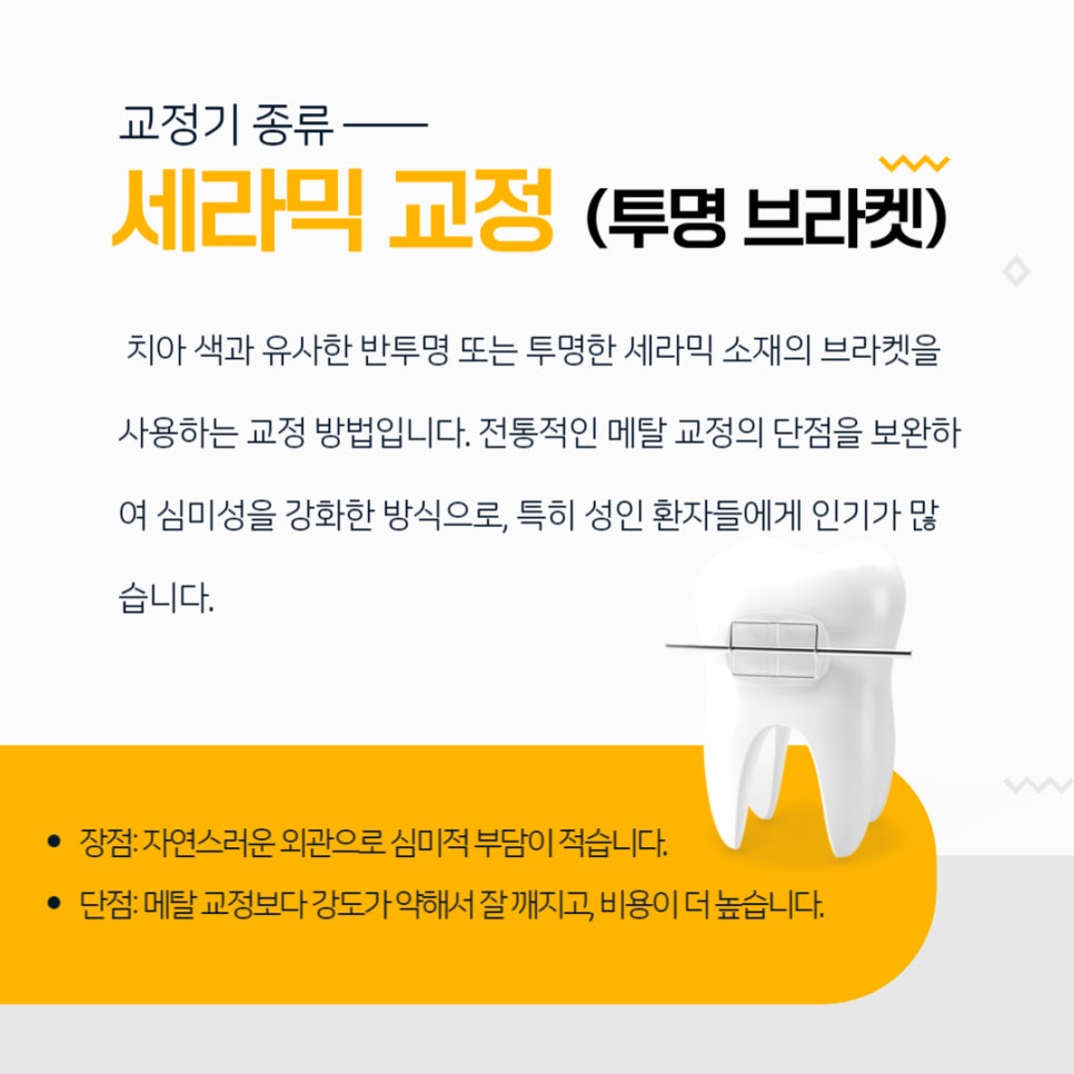 치아교정 종류 장단점 알아보기 관련 이미지 3