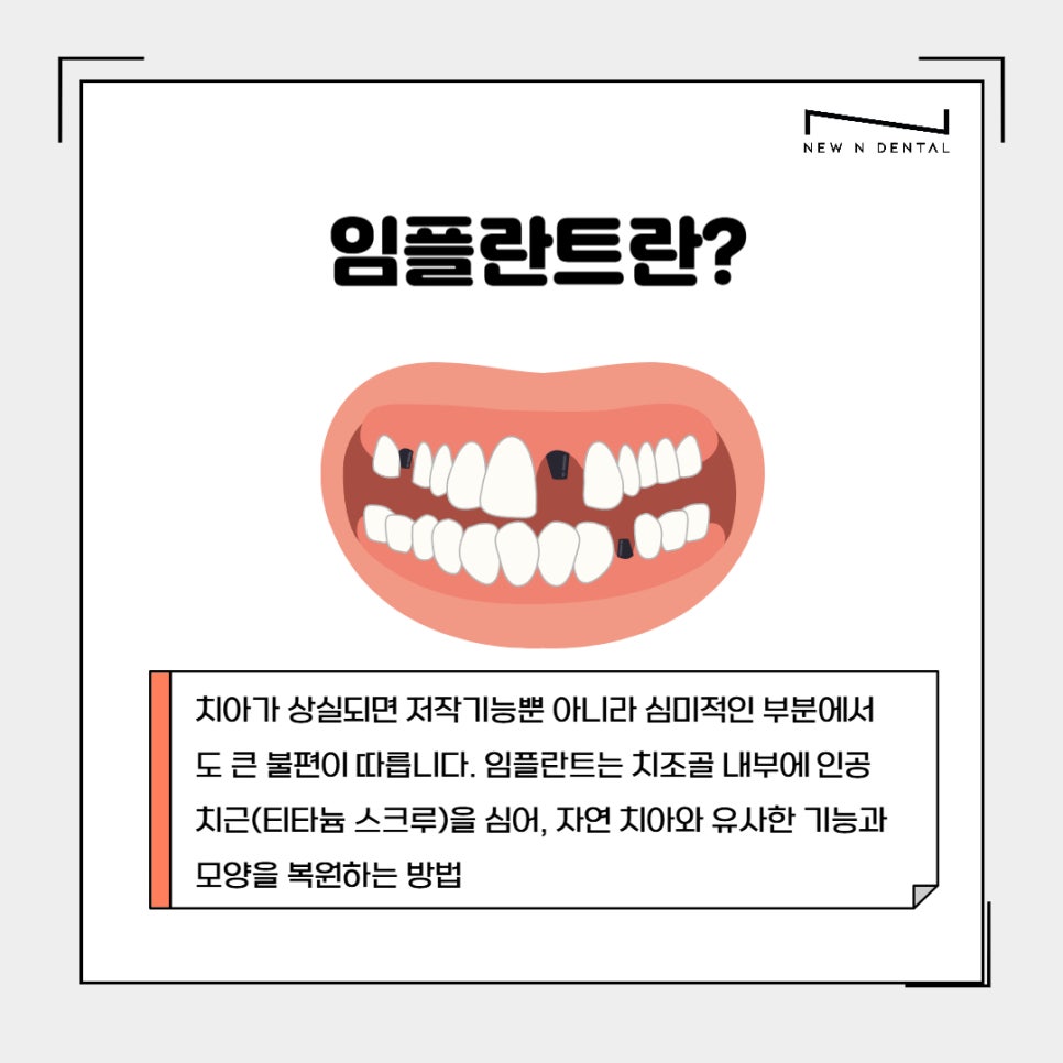 강남임플란트치과 치료부터 뼈이식까지 관련 이미지 2