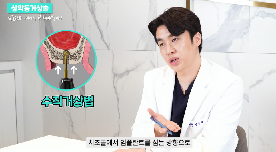 상악동거상술 임플란트 성공률 높이기 관련 이미지 7