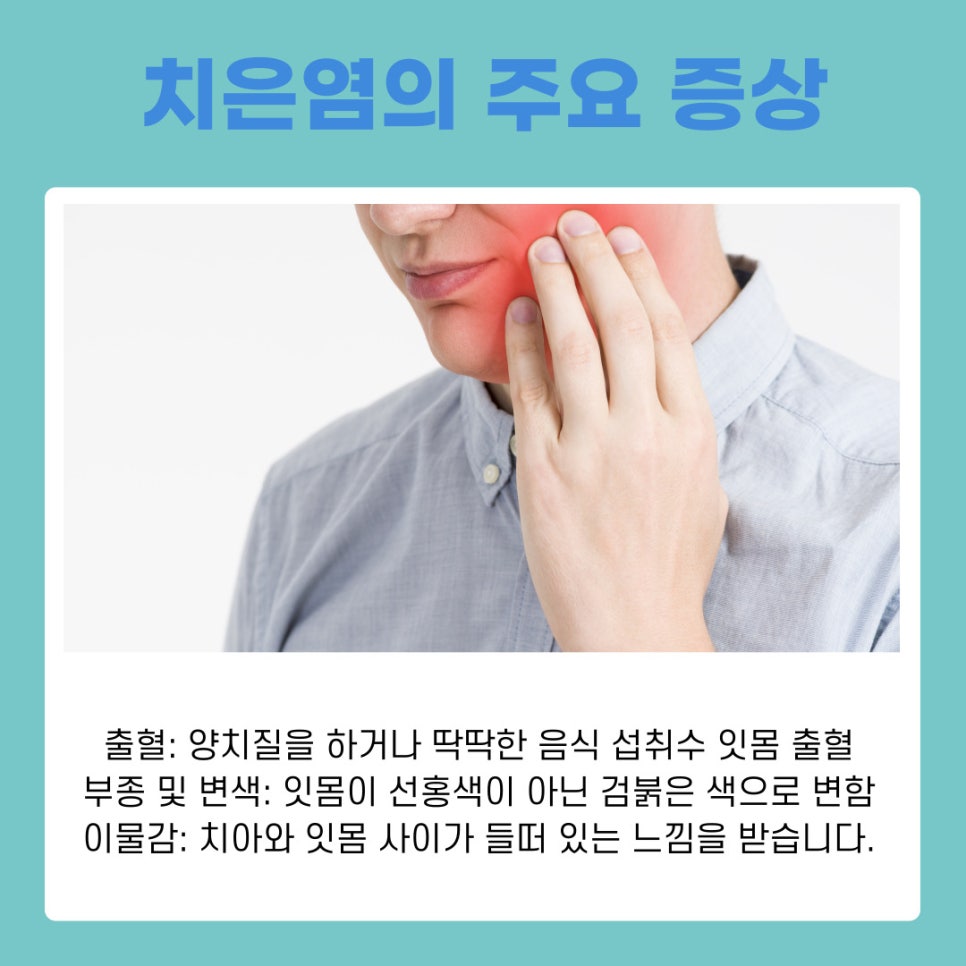 Gingivitis Treatment and Management: A Guide to Healthy Gums image 7