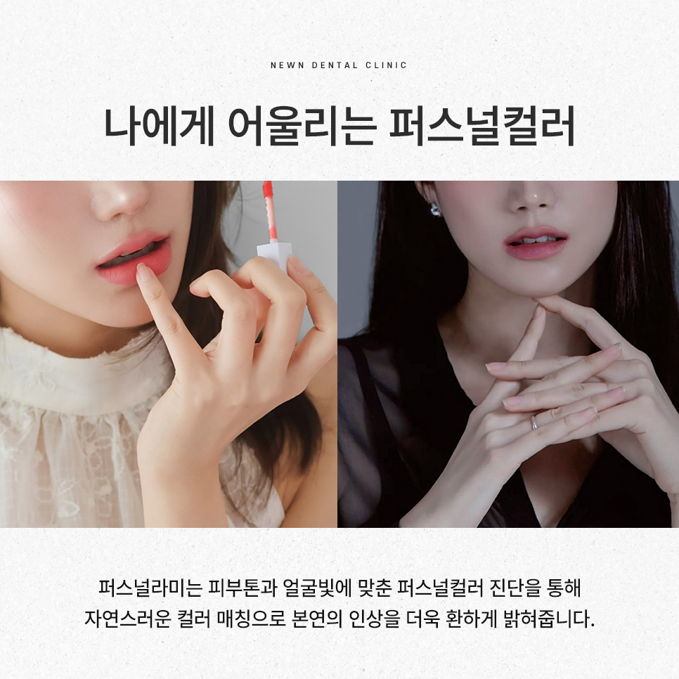 강남역 뉴엔치과 일반 라미네이트와 퍼스널라미의 차이점 관련 이미지 4