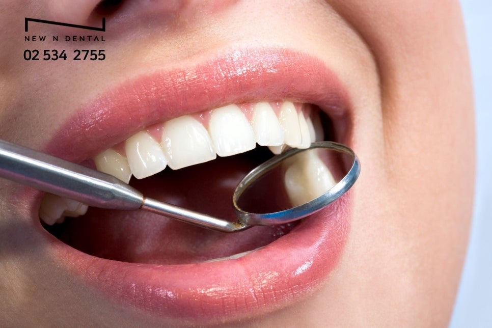 서울라미네이트치과 검색후 뉴엔치과에 오시는 진짜 이유 관련 이미지 4