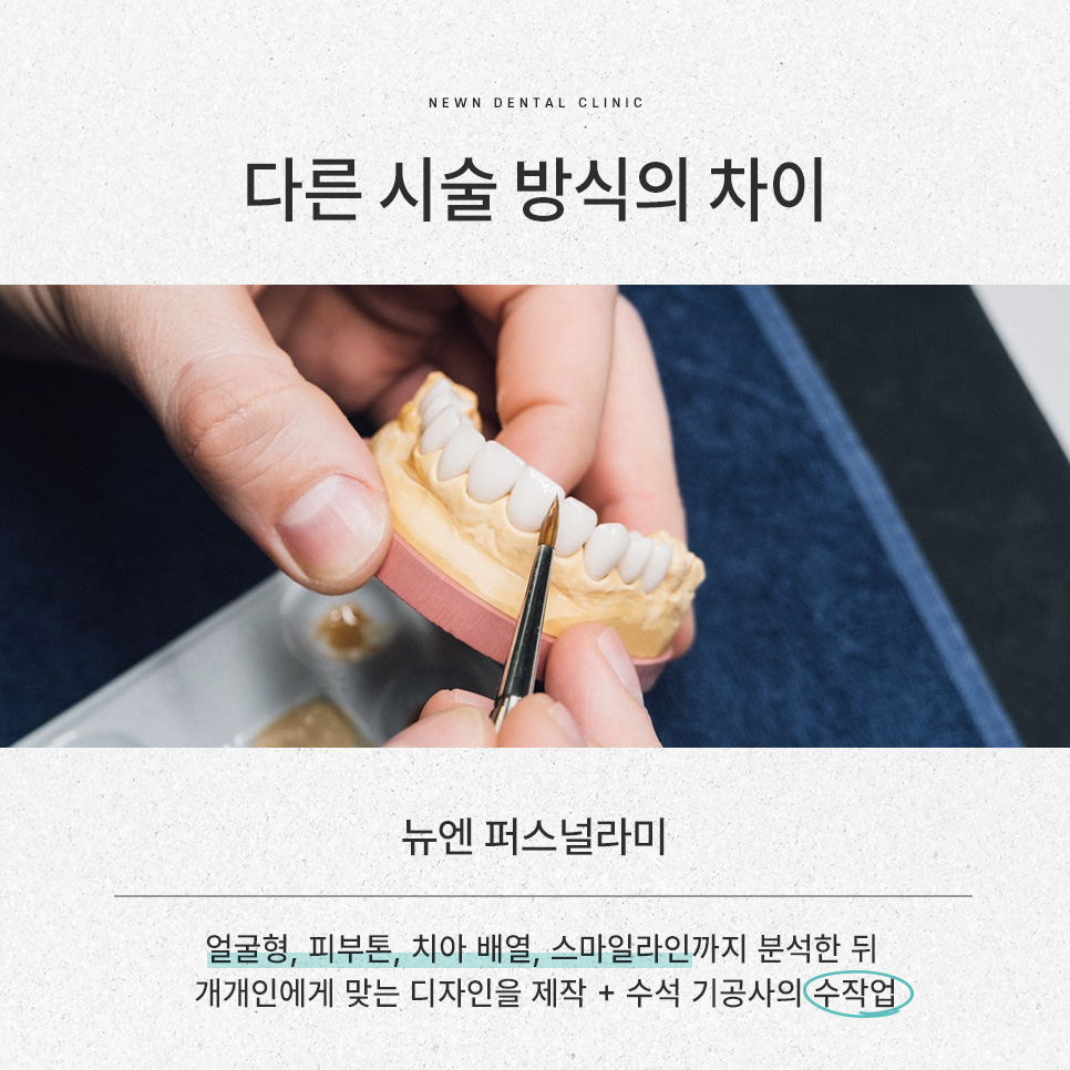 강남역 뉴엔치과 일반 라미네이트와 퍼스널라미의 차이점 관련 이미지 9