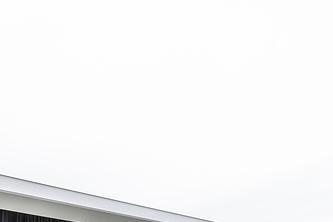 원데이 치아미백 변색의 원인과 후유증 없는 찐후기 관련 이미지 20