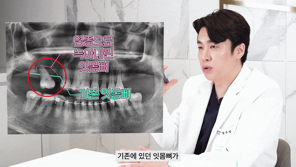 서울강남치과 빠르고 정확한 임플란트의 비결 관련 이미지 5