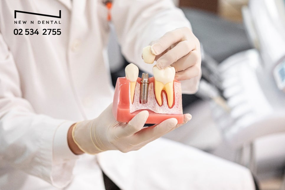 서울강남치과 빠르고 정확한 임플란트의 비결 관련 이미지 6