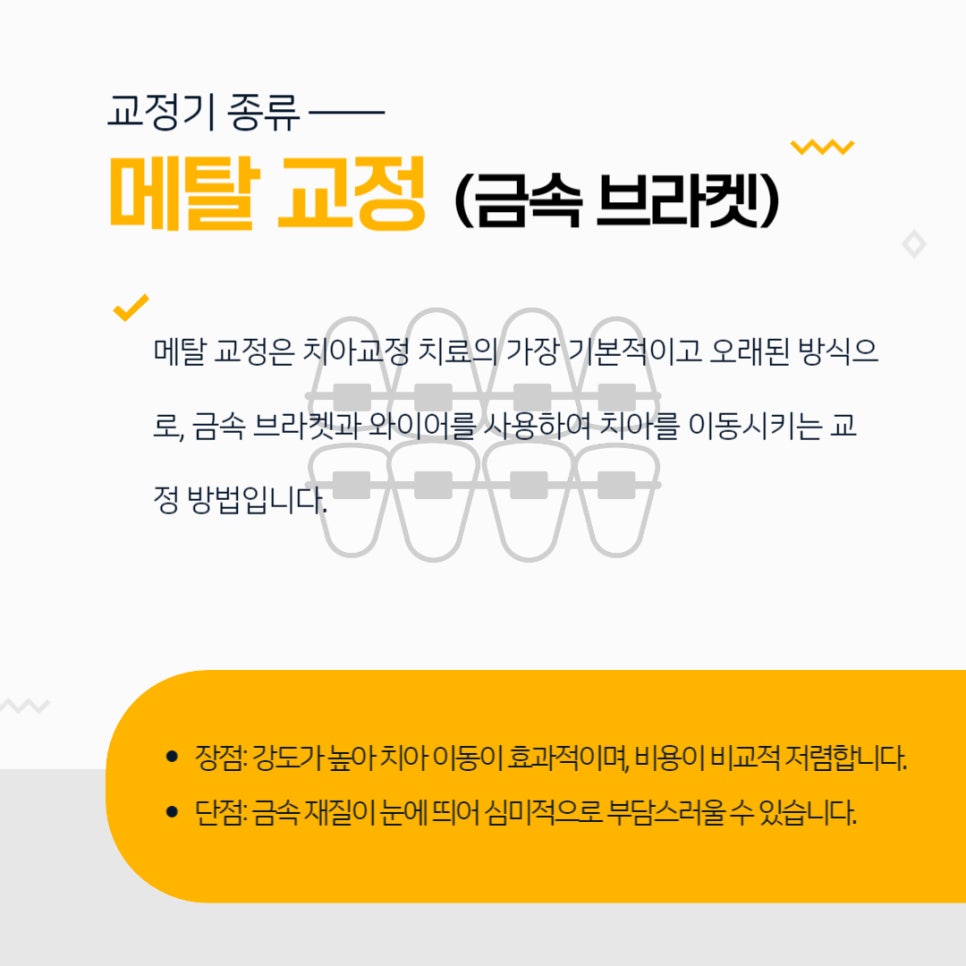 치아교정 종류 장단점 알아보기 관련 이미지 2