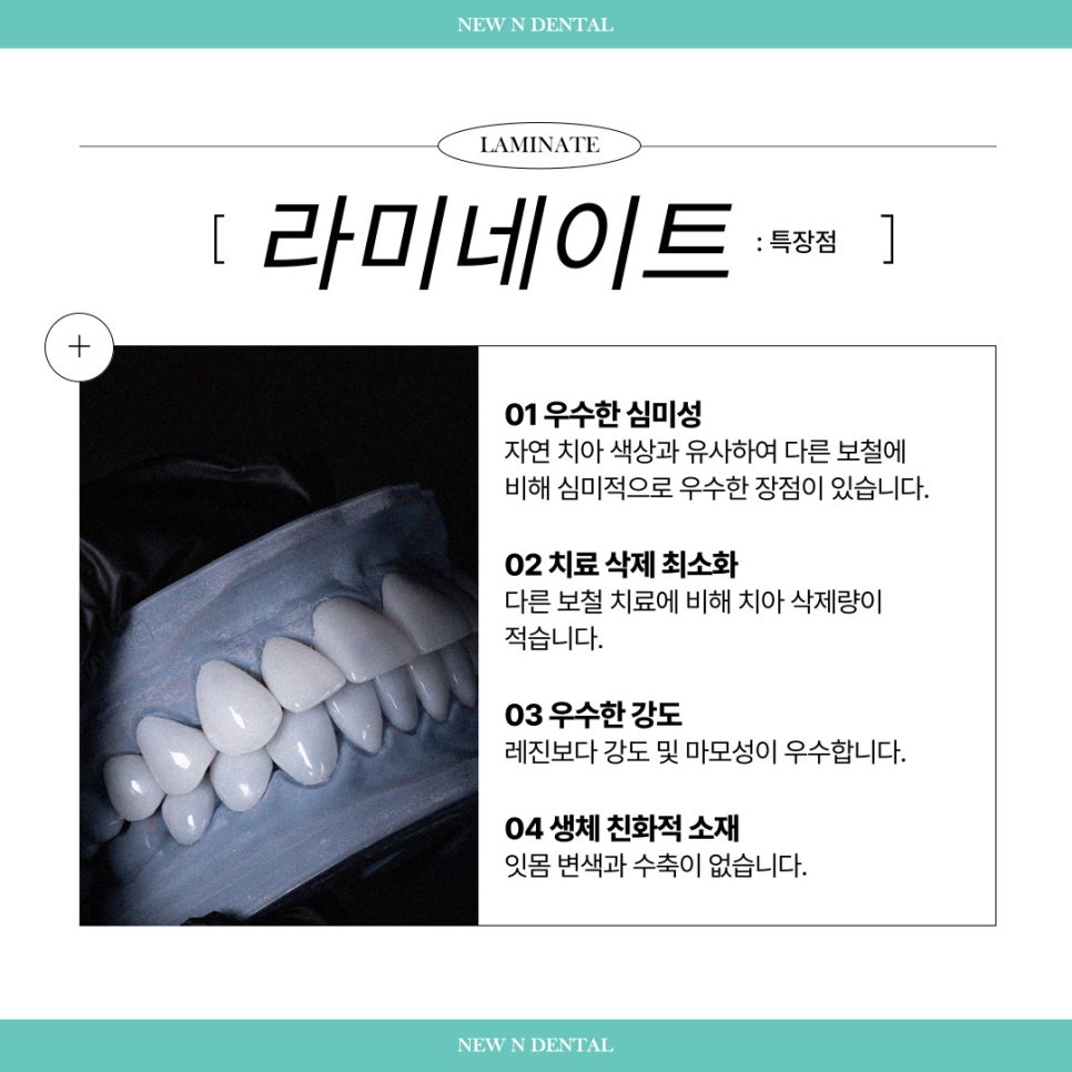 앞니심미치료로 되찾는 자연스러운 스마일 라인 관련 이미지 9
