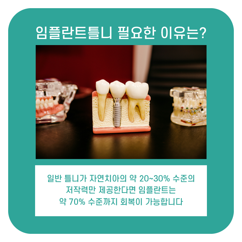 강남임플란트틀니 치아 기능과 심미성 회복하는 방법 관련 이미지 5