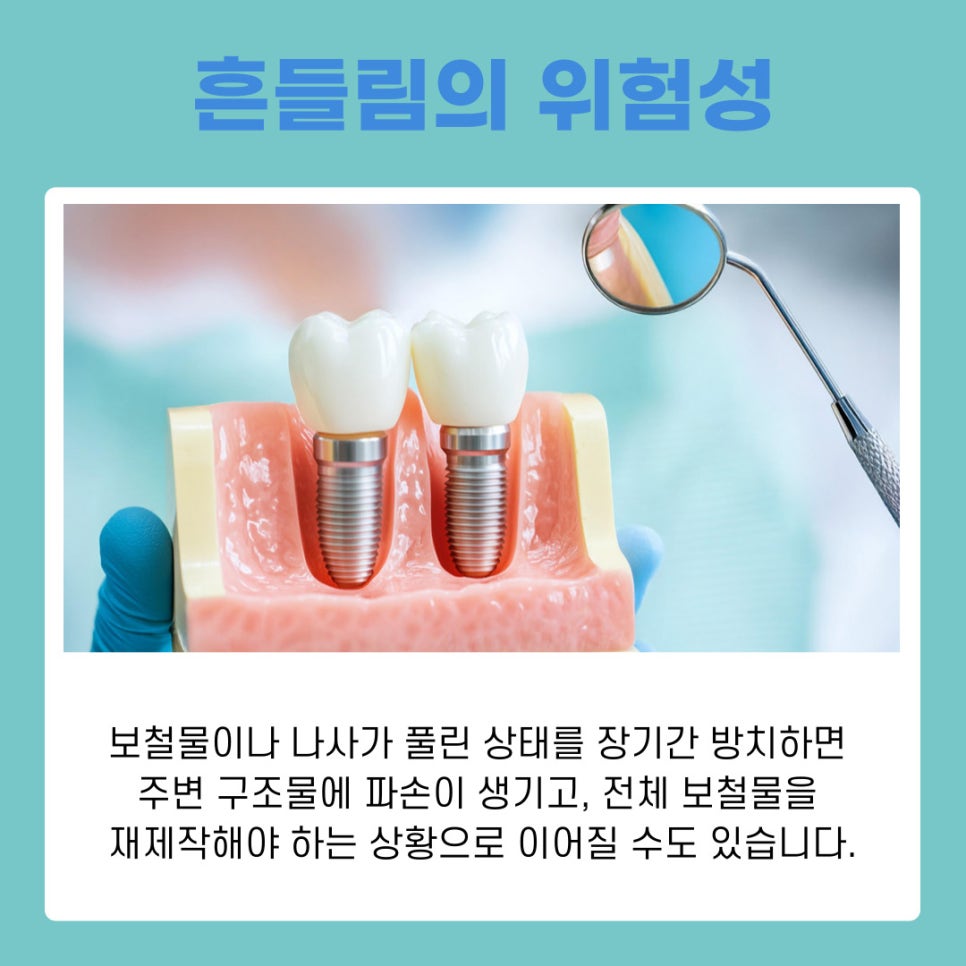 강남역임플란트치과 흔들림 발생 시 확인해야 할 원인과 대응법 관련 이미지 6