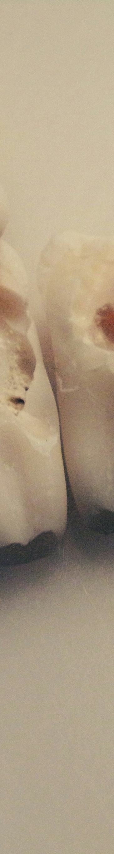 사랑니 발치 전 후 관리법 꿀팁 관련 이미지 21