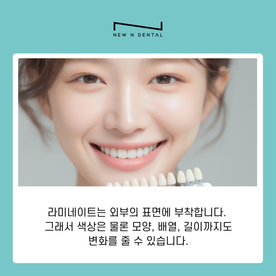 역삼동치과 라미네이트 하고 싶다면 어떤 점을 고려할까 관련 이미지 4