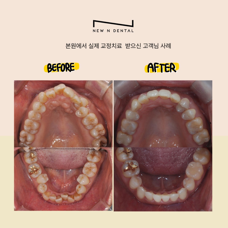 Gangnam Orthodontic Dental Clinic: Learn Carefully and Thoroughly image 5