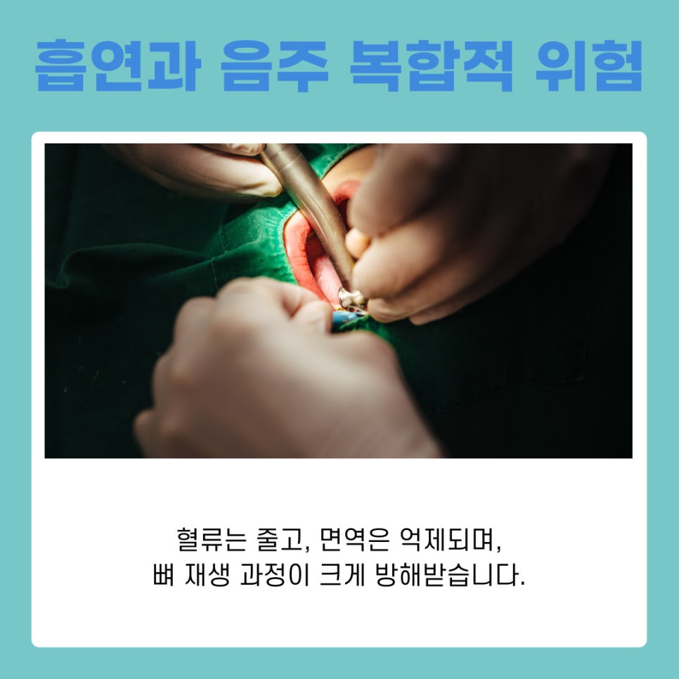 강남역치과 임플란트 뼈이식, 흡연과 음주가 미치는 영향은? 관련 이미지 6