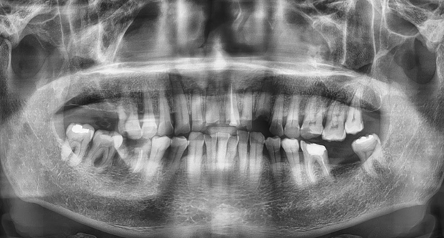 서초임플란트 경험과 디지털로 명확하게 관련 이미지 4