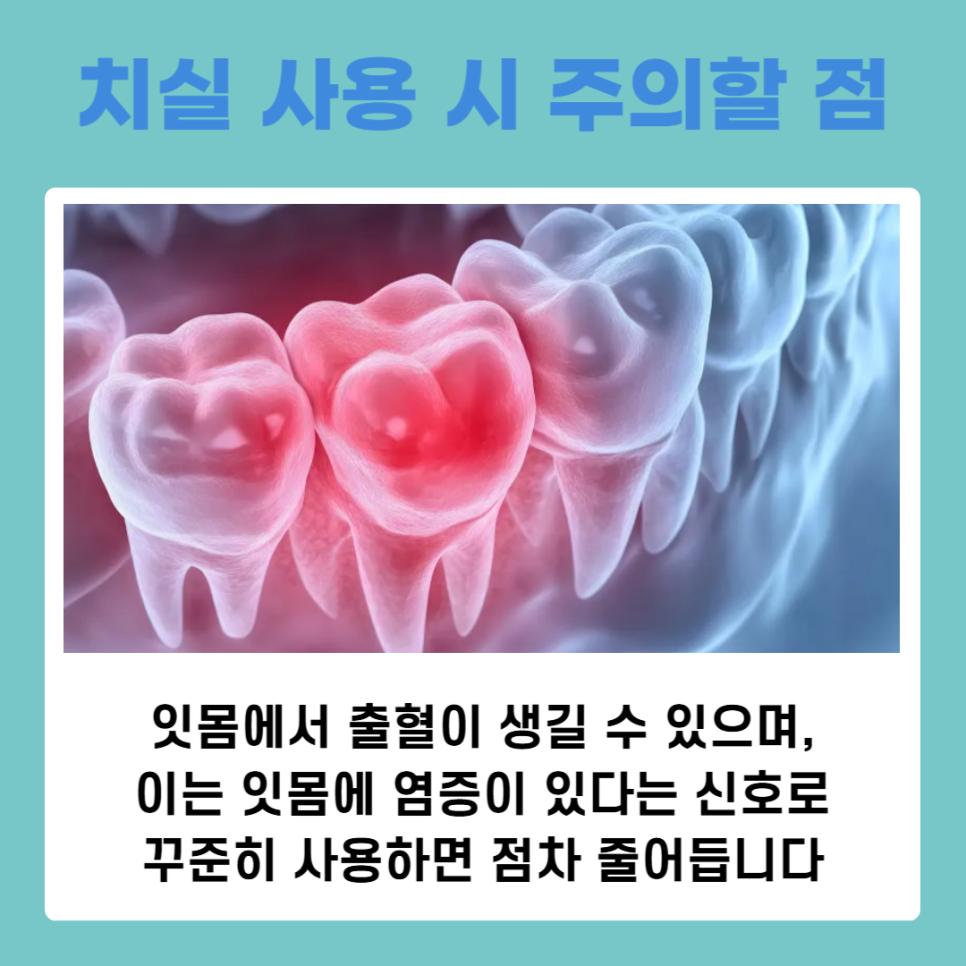 건강한 구강을 위한 치아관리방법, 치실사용순서 제대로 알기 관련 이미지 9