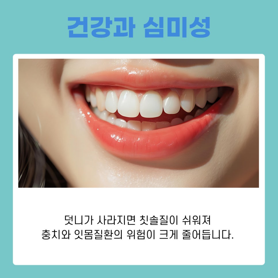 강남역교정치과 덧니발치교정 치아 건강과 심미성 모두 잡는 방법 관련 이미지 8