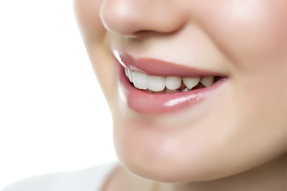 강남구치과추천 티없는 치아의 자신감 관련 이미지 6