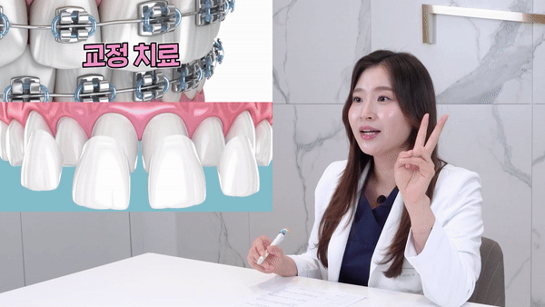 서울앞니라미네이트 단 하루만에 달라지는 미소 관련 이미지 5