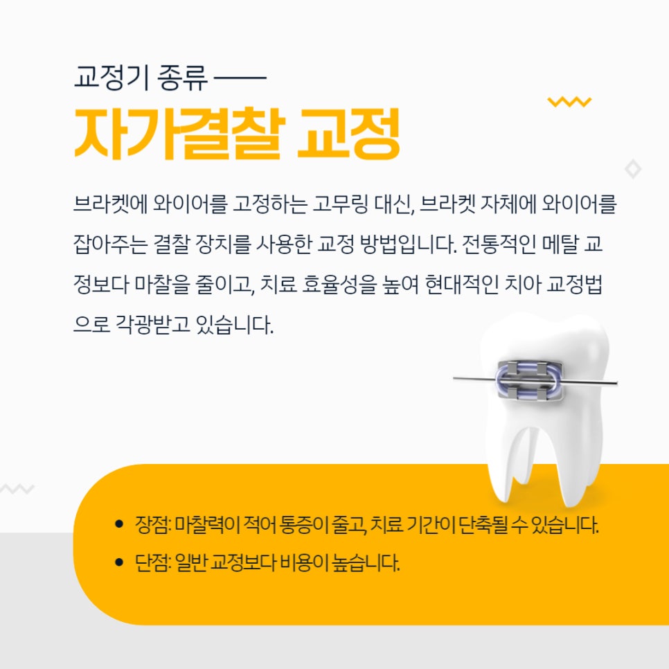 치아교정 종류 장단점 알아보기 관련 이미지 4