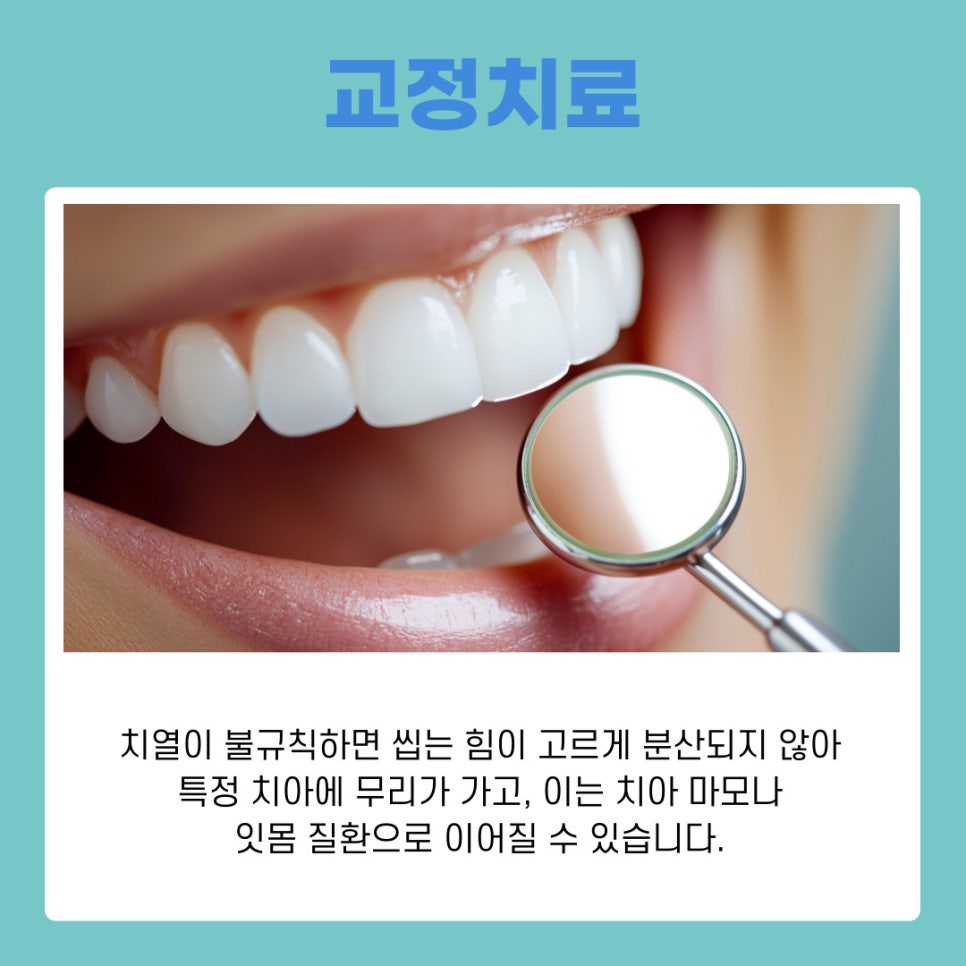 신사동 교정치과 투명교정 시작 전 꼭 알아야 할 체크리스트 관련 이미지 3