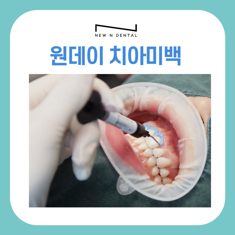 원데이 치아미백 변색의 원인과 후유증 없는 찐후기 관련 이미지 4