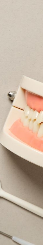 임플란트 재수술, 꼭 필요한 경우만 진행해야 합니다 관련 이미지 15