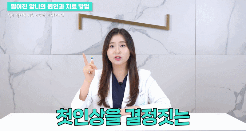 앞니 벌어짐 치료의 원인과 치료 방법 관련 이미지 2