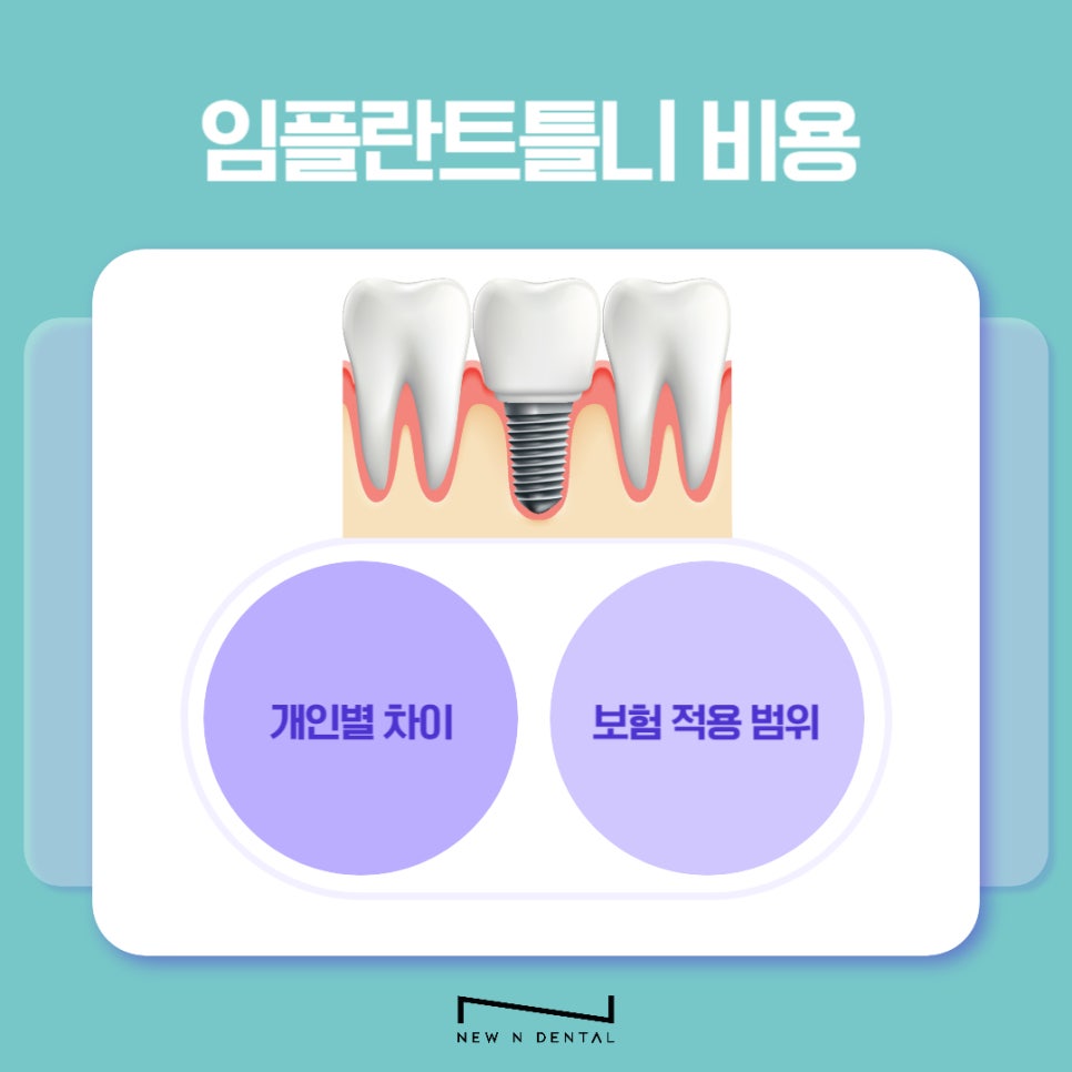 Implant Dentures for a Healthy Fit Without Wobbling image 10