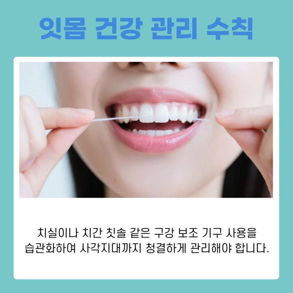 치아 건강의 핵심 서초역치과 연 1회 스케일링으로 치주염 예방 관련 이미지 7