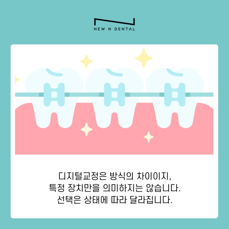 디지털교정 기존 치료와 무엇이 다를까 관련 이미지 7