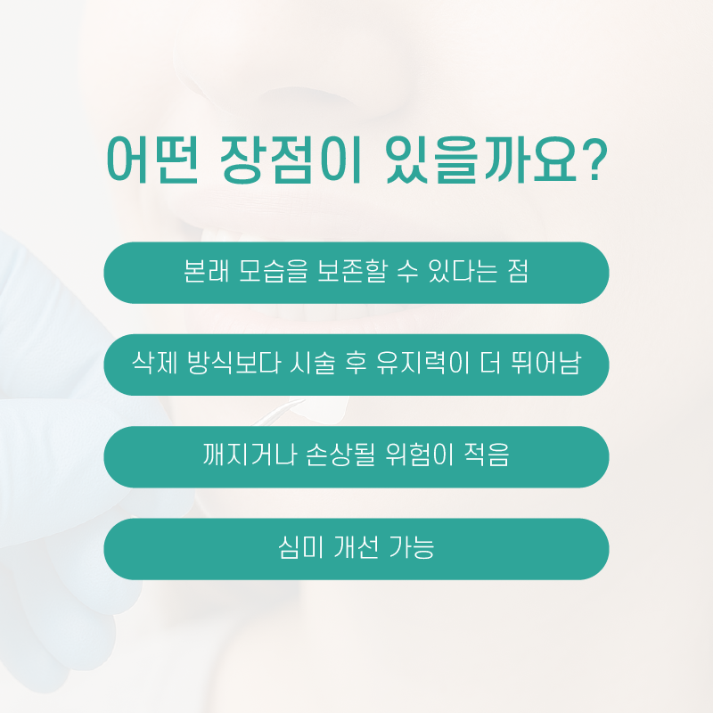 무삭제 라미네이트 저도 받을 수 있을까요? 관련 이미지 5