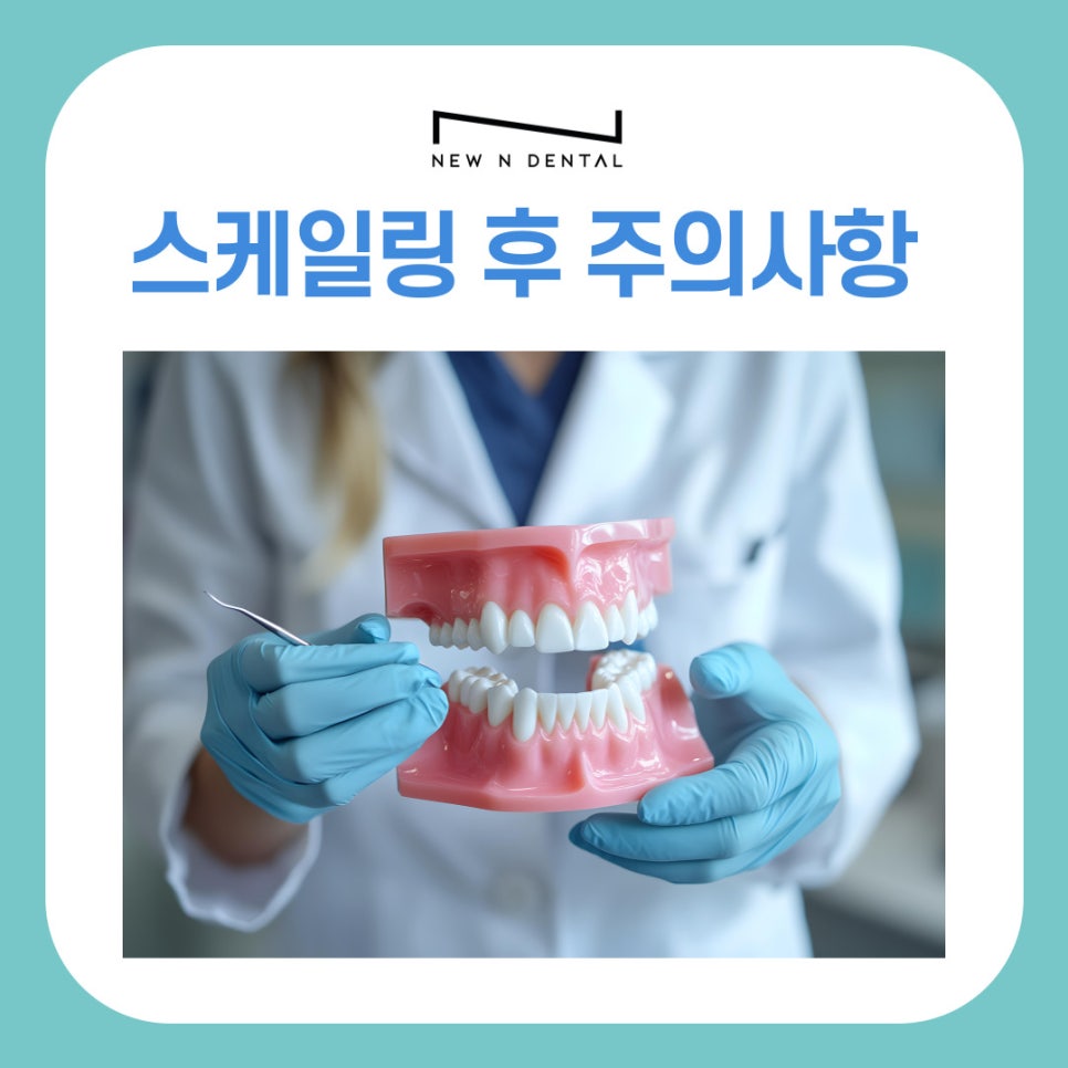 강남 역삼동 스케일링 후 주의사항 이런 행동은 피해주세요 관련 이미지 2