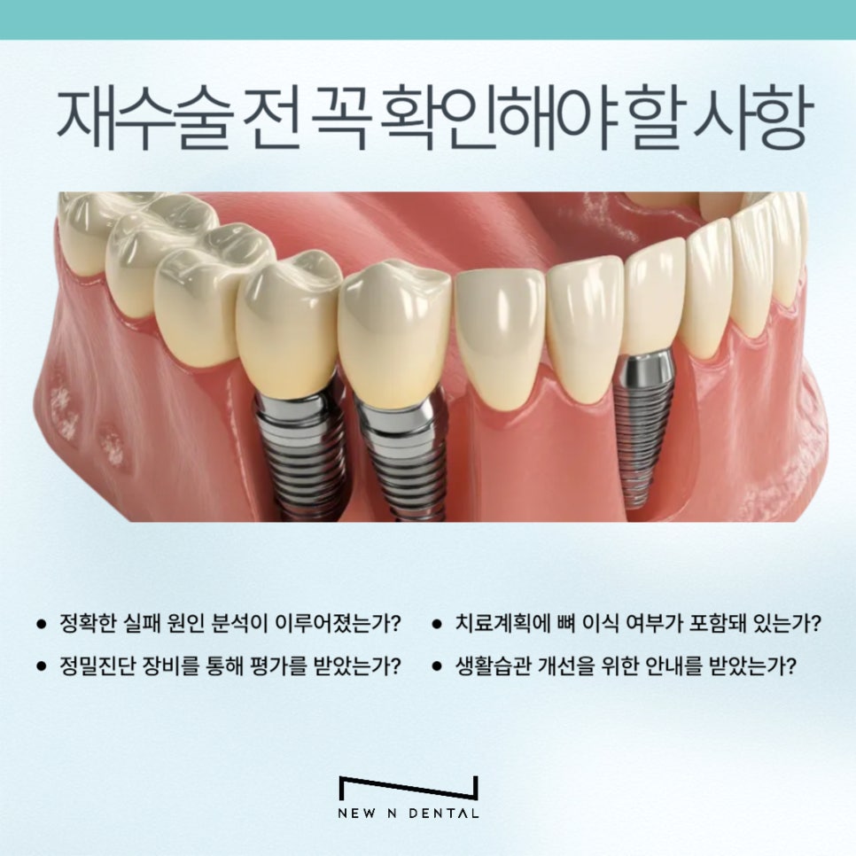 강남 임플란트 재수술, 어떤 경우에 필요할까 관련 이미지 6