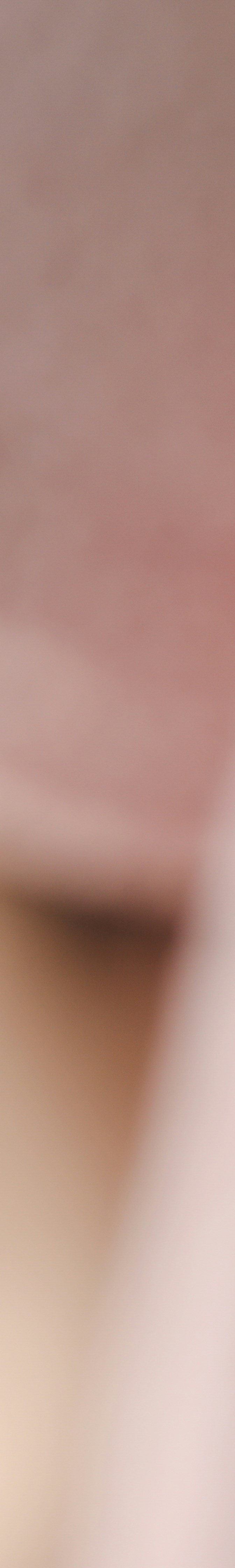 치아 미백 효과와 부작용 체크해야 할 사항 관련 이미지 14