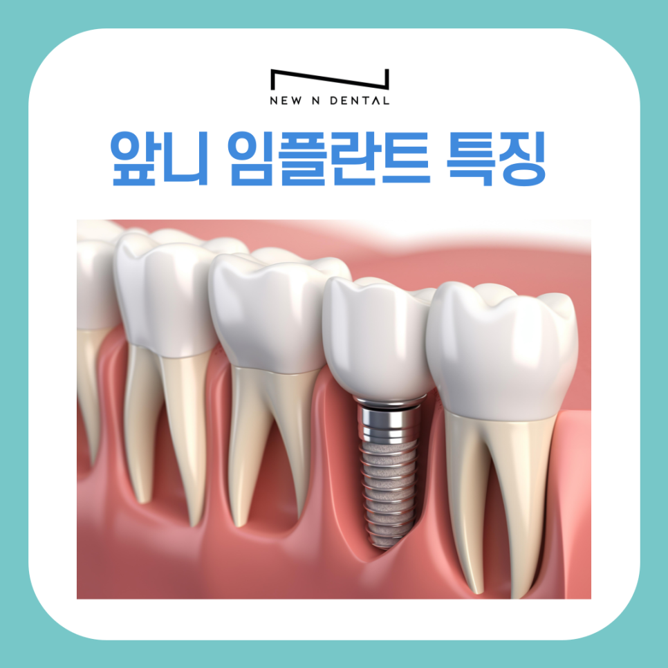 앞니 임플란트 식립 주의해야 할 사항은? 관련 이미지 5