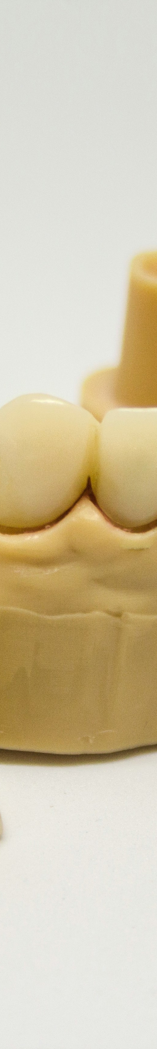 임플란트 후 관리의 중요성 관련 이미지 22