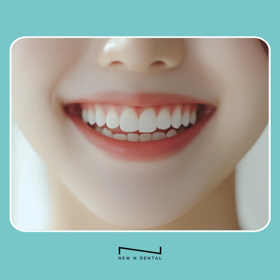 논현역 치과 원데이 치아미백 중요한 날 앞두고 많이 찾는 이유 관련 이미지 8