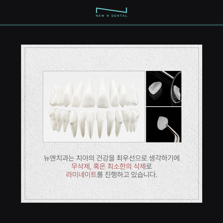 강남구치과추천 티없는 치아의 자신감 관련 이미지 3