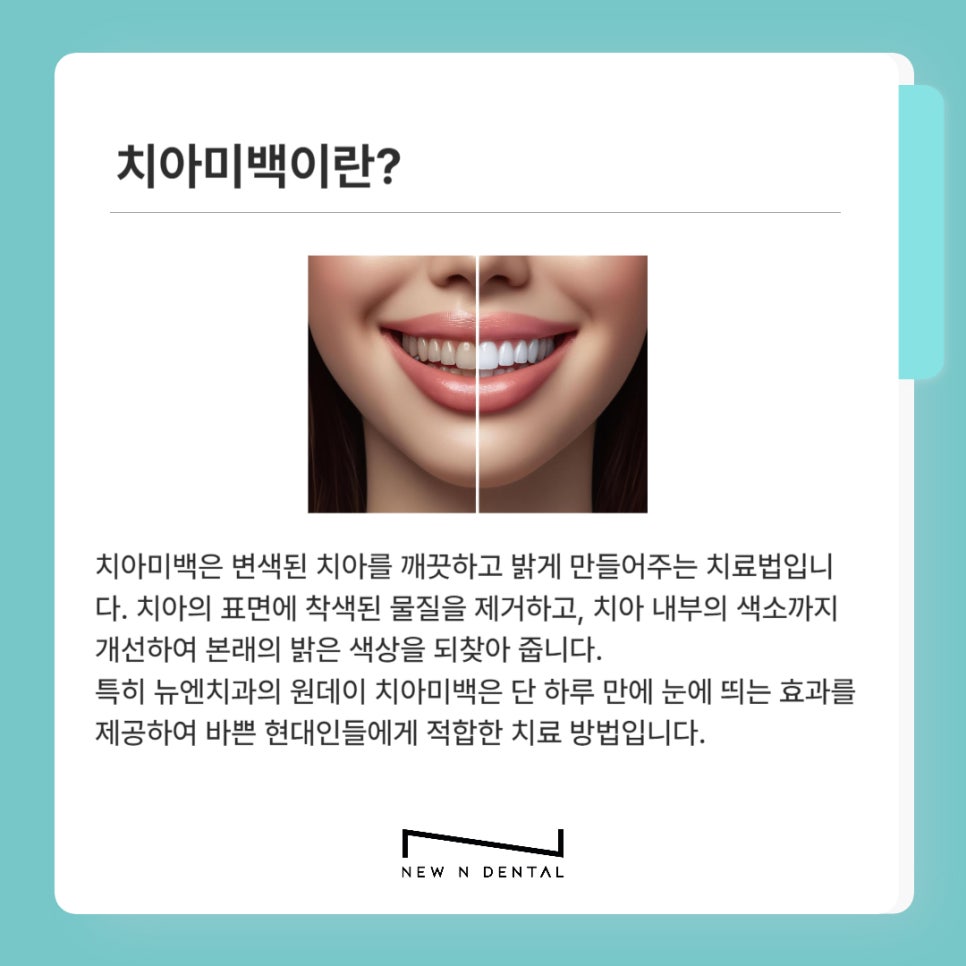 원데이치아미백 으로 누렁니 탈출 관련 이미지 2