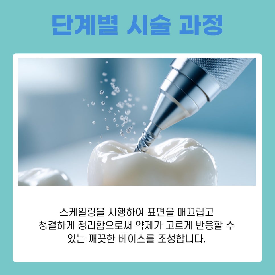 Gangnam Teeth Whitening: A Choice for Regaining a Clear and Radiant First Impression image 7