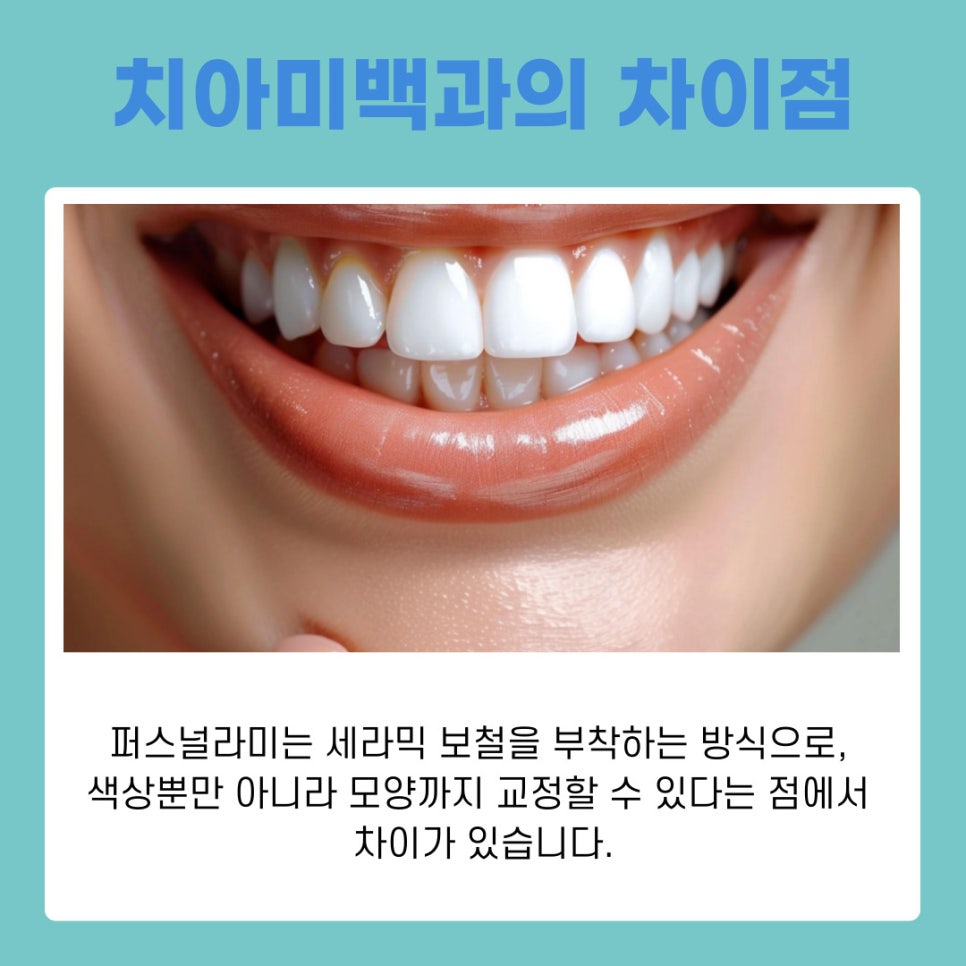 강남역치과추천 퍼스널라미 시술후 관리 가이드 관련 이미지 4