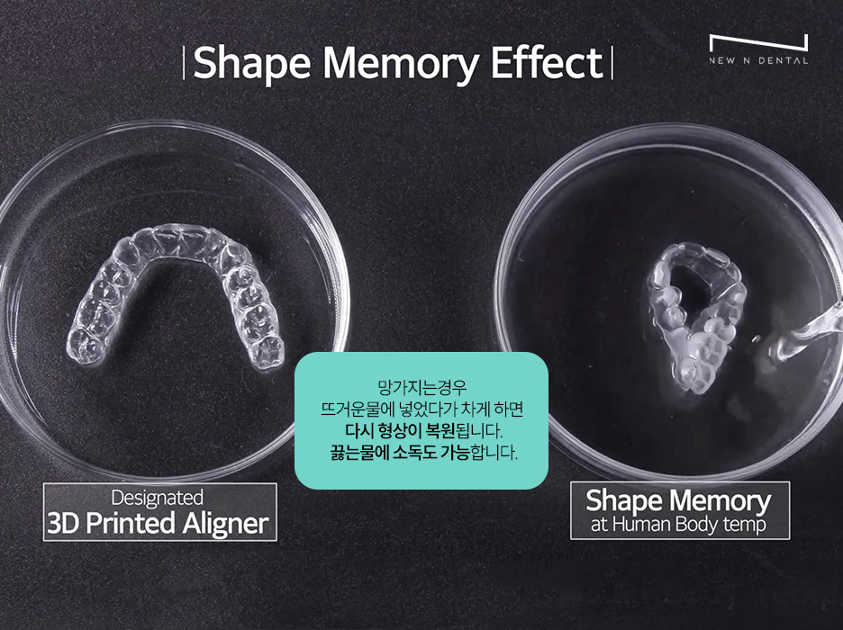 강남교정치과 티안나는 뉴엔 투명교정 관련 이미지 7